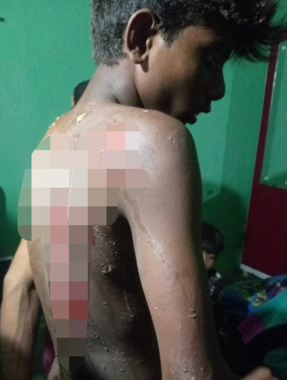 UPDATE:अंगार में धकेलने वालों पर जुर्म दर्ज,पुलिस कर रही पड़ताल