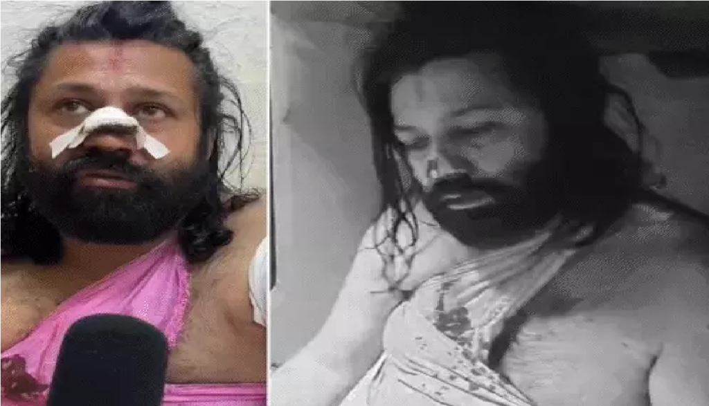 Ashutosh Maharaj Attack